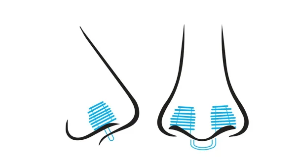 Tapón nasal NOSSA - Imagen 2